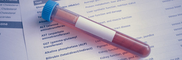 A blood test tube on a lab report: the health record Claude reads through the connector