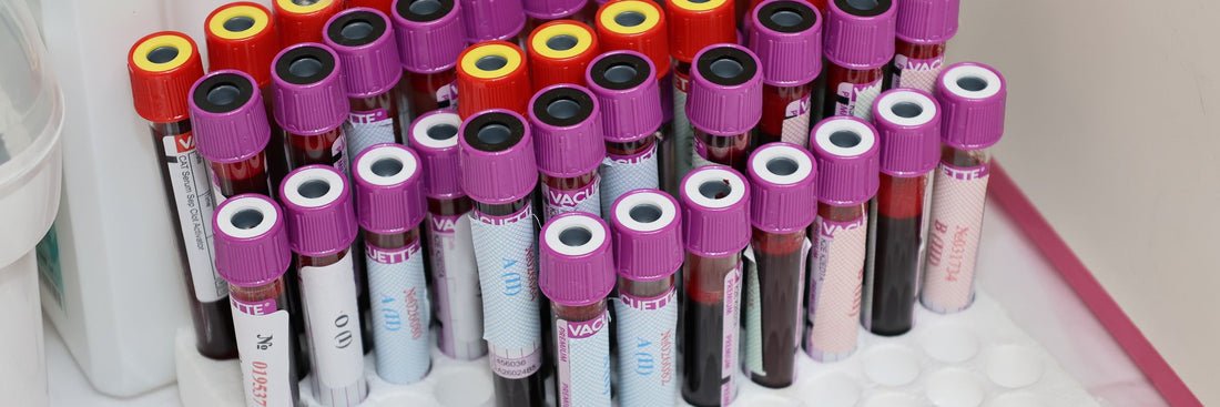 Massive Lp(a) Cholesterol Study FAILED. Now What?