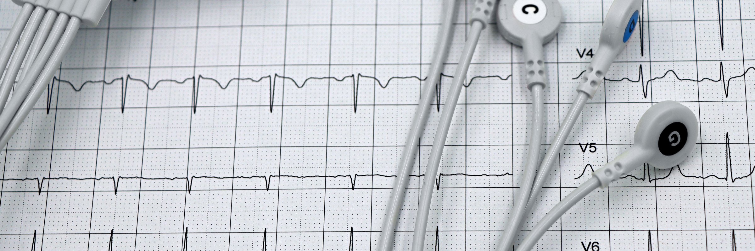 They Erased Their Inflammation. The Heart Attacks Kept Coming.